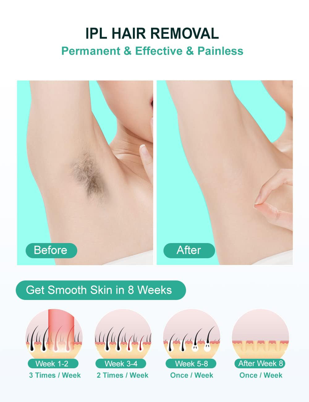 At-Home IPL Laser Hair Removal Device for Women and Men Permanent Hair Removal 999,999 Flashes Painless Hair Remover on Armpits Back Legs Arms Face Bikini Line